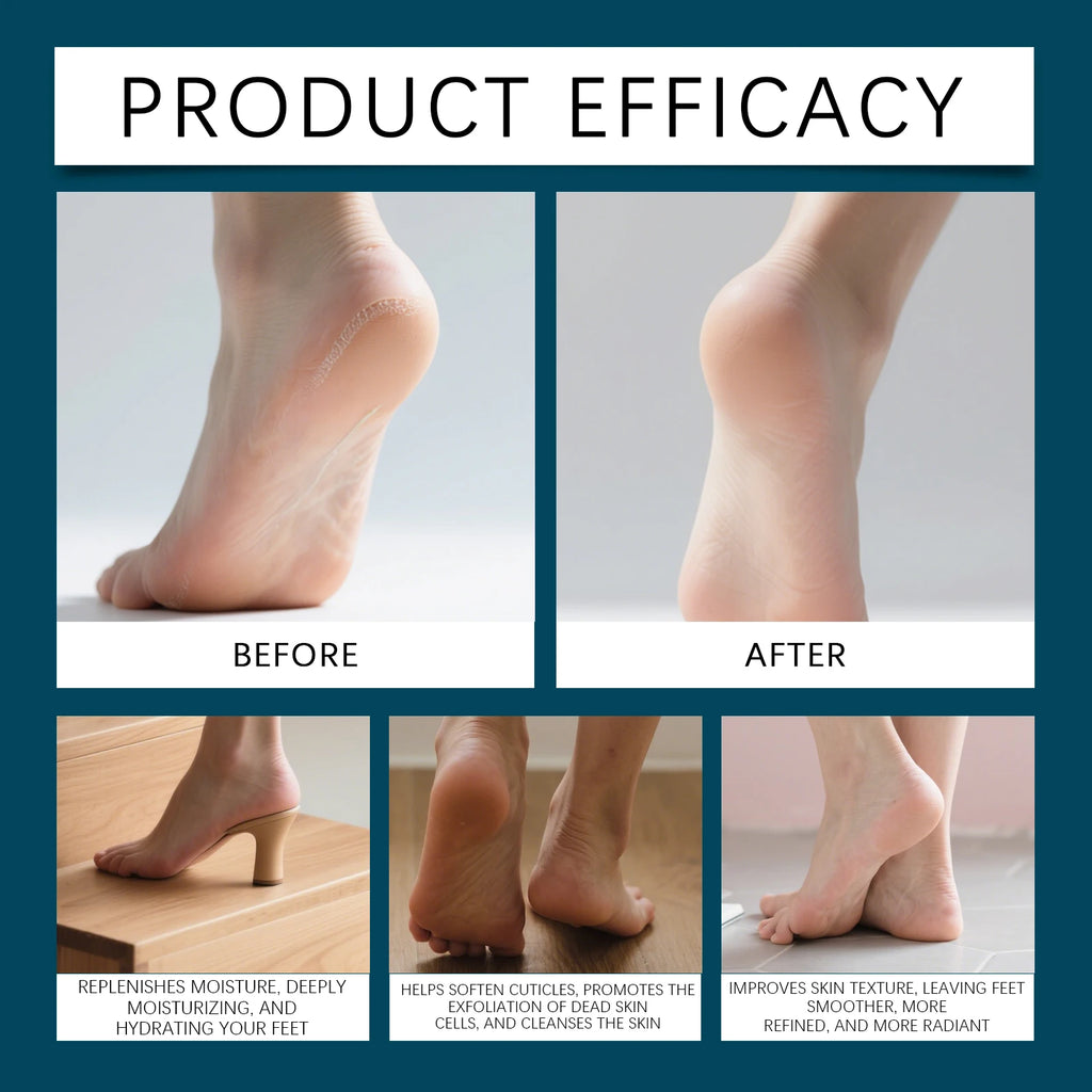 OCEAURA Foot Cuticle & Callus Remover